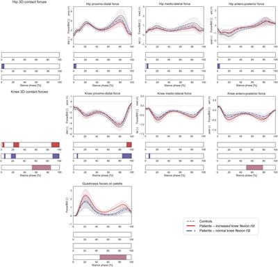 Increased Femoral Anteversion Does Not Lead to Increased Joint Forces During Gait in a Cohort of Adolescent Patients